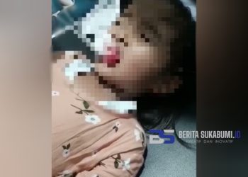 Akibat Lato-lato, Bibir Seorang Anak Perempuan di Cicurug Sobek Hingga Harus Dilarikan ke Rumah Sakit