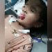 Akibat Lato-lato, Bibir Seorang Anak Perempuan di Cicurug Sobek Hingga Harus Dilarikan ke Rumah Sakit