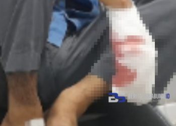 Terkena Sabetan Clurit, Jari Tangan Sebelah Kanan Seorang Pelajar SMK di Cicurug Nyaris Putus 