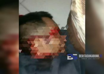 Seorang Pria Asal Ciambar Dibacok OTK Hingga Luka Parah, Polisi Buru Pelaku