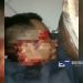 Seorang Pria Asal Ciambar Dibacok OTK Hingga Luka Parah, Polisi Buru Pelaku