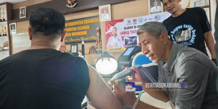 Ruang Peduli Sukabumi Ikut Partisipasi, Gelar Kegiatan Hapus Tato Gratis Bagi Masyarakat
