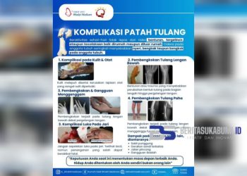 RS Bhakti Medicare Ingatkan Bahaya Patah Tulang: Jangan Disepelekan, Bisa Sebabkan Komplikasi Serius