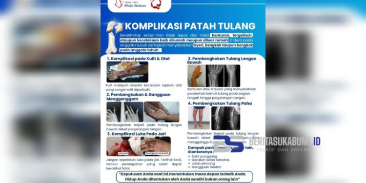 RS Bhakti Medicare Ingatkan Bahaya Patah Tulang: Jangan Disepelekan, Bisa Sebabkan Komplikasi Serius